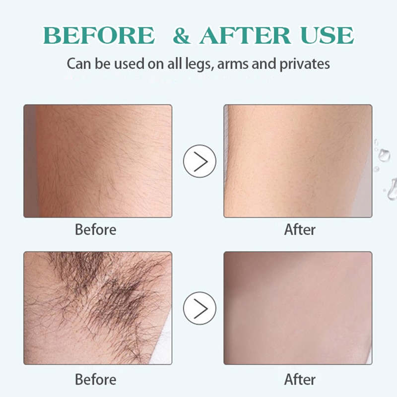 Hair Removal repair Essence liquid Hyaluronic Acid Hair removal Serum Hair Growth Inhibitor For Depilation Facial Leg Body Care