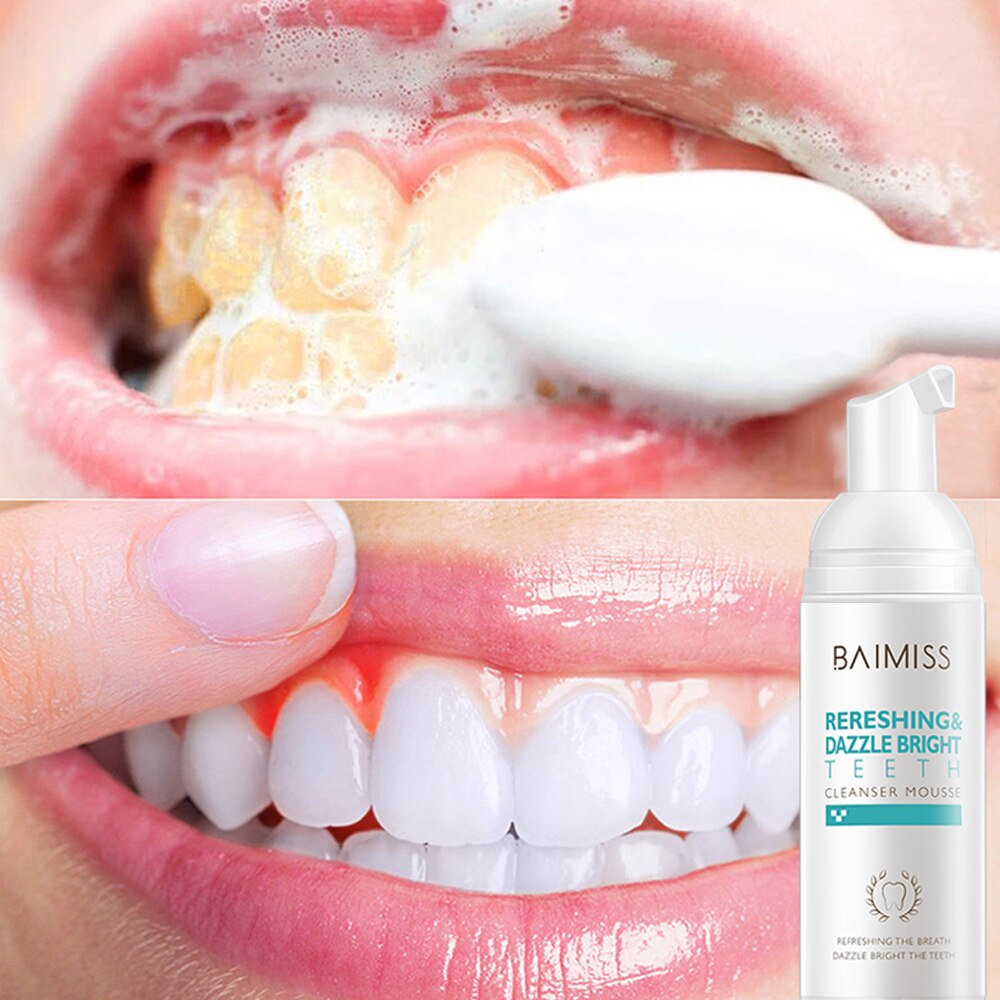 BAIMISS Fresh Shining Tooth-Cleaning Mousse Toothpaste Teeth Whitening Oral Hygiene Removes Plaque Stains Bad Breath Dental Tool