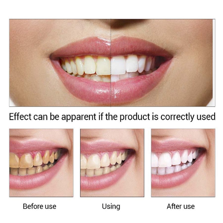 EFERO Teeth Whitening Serum Gel Dental Oral Hygiene Effective Remove Stains Plaque Teeth Cleaning Essence Dental Care Toothpaste