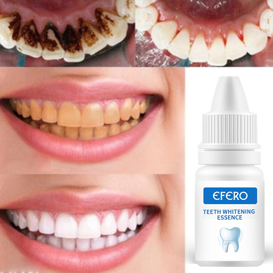 EFERO Teeth Whitening Serum Gel Dental Oral Hygiene Effective Remove Stains Plaque Teeth Cleaning Essence Dental Care Toothpaste