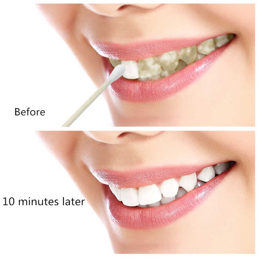 EFERO Teeth Whitening Serum Gel Dental Oral Hygiene Effective Remove Stains Plaque Teeth Cleaning Essence Dental Care Toothpaste