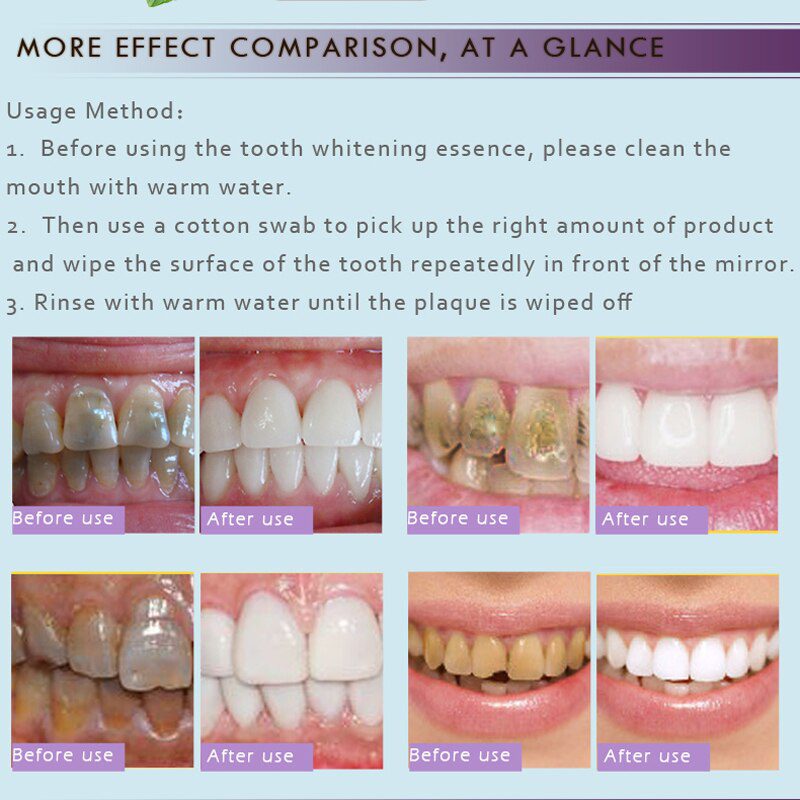 LANBENA Teeth Whitening Essence Powder Oral Hygiene Cleaning Serum Removes Plaque Stains Tooth Bleaching Dental Tools Toothpaste