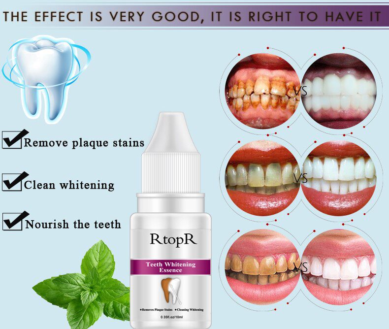 LANBENA Teeth Whitening Essence Powder Oral Hygiene Cleaning Serum Removes Plaque Stains Tooth Bleaching Dental Tools Toothpaste