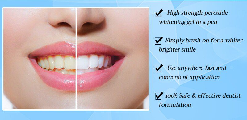 EFERO White Teeth Whitening Pen Tooth Gel Whitener Bleach Remove Plaque Stains Dental Tools Oral Hygiene Teeth Cleaning Serum