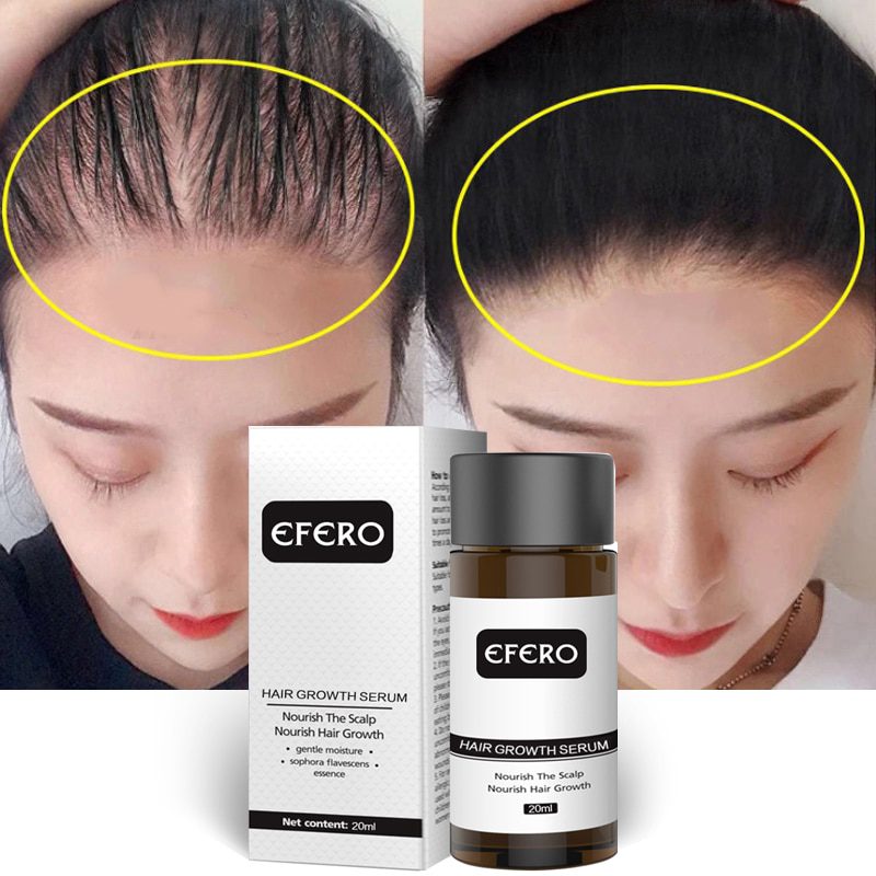 Hair Growth Essence Hair Loss Dense Hair Fast Hair Growth Oil Grow Restoration Growing Serum