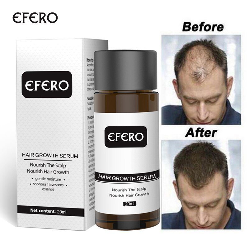 Hair Growth Essence Hair Loss Dense Hair Fast Hair Growth Oil Grow Restoration Growing Serum