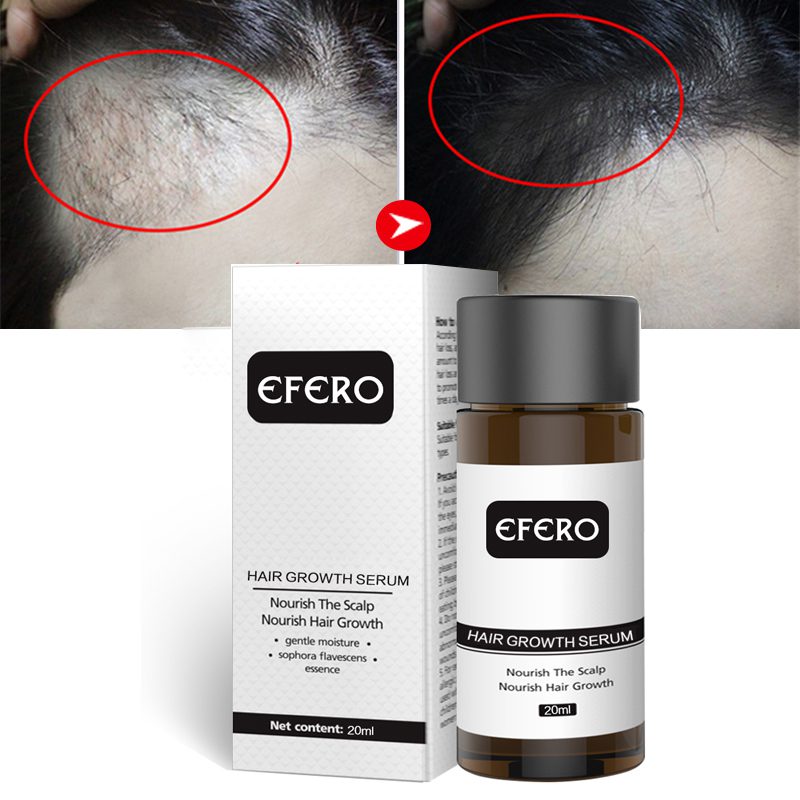 Hair Growth Essence Hair Loss Dense Hair Fast Hair Growth Oil Grow Restoration Growing Serum