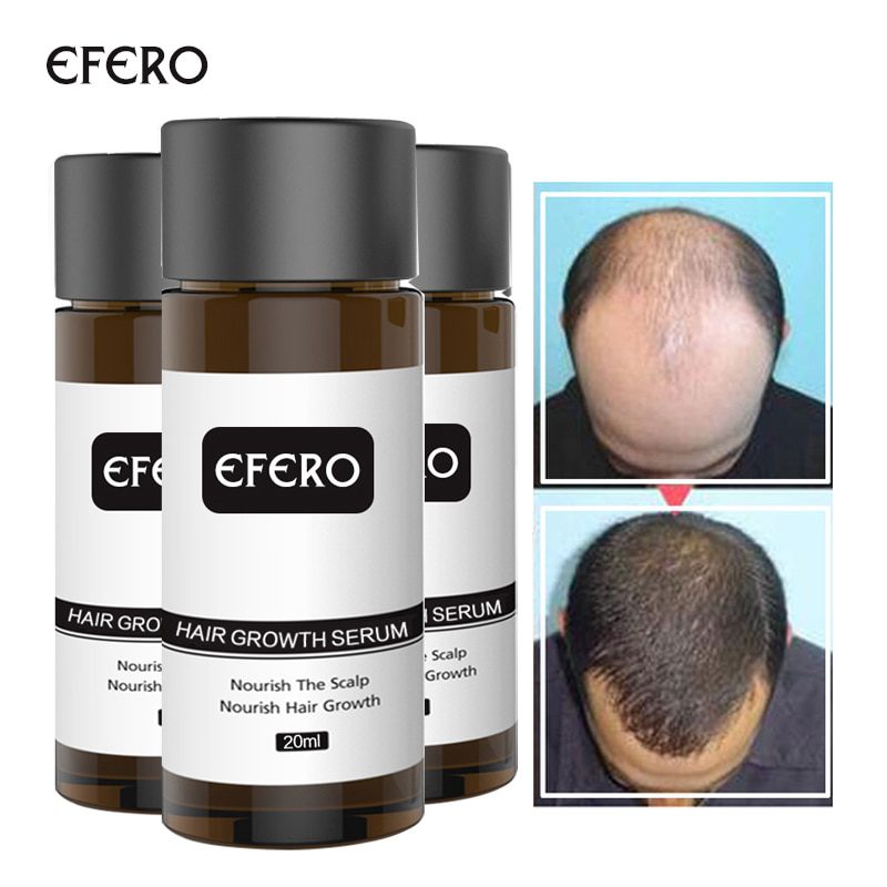 Hair Growth Essence Hair Loss Dense Hair Fast Hair Growth Oil Grow Restoration Growing Serum