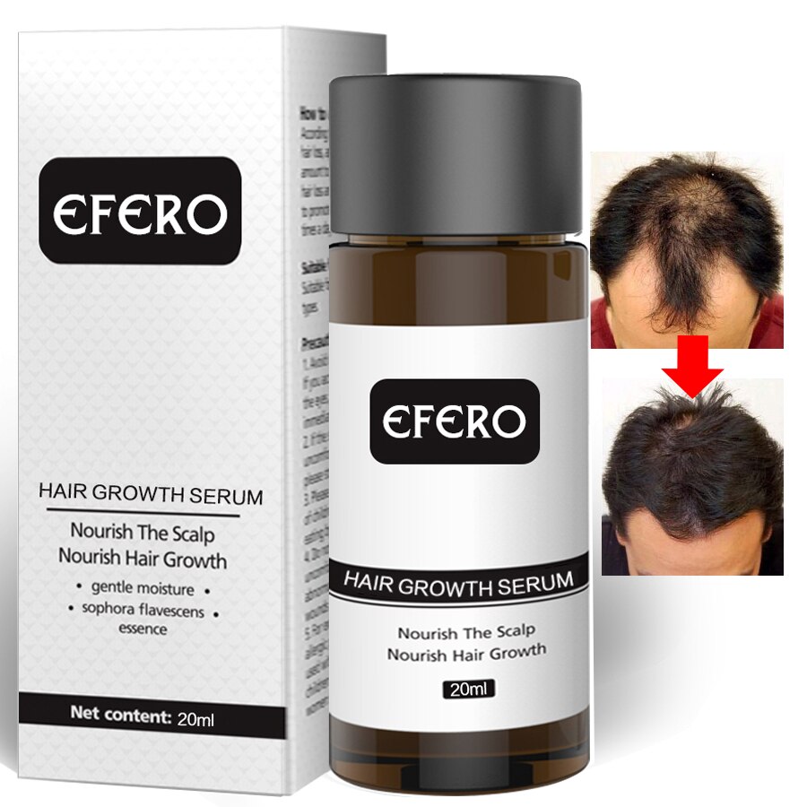 Hair Growth Essence Hair Loss Dense Hair Fast Hair Growth Oil Grow Restoration Growing Serum