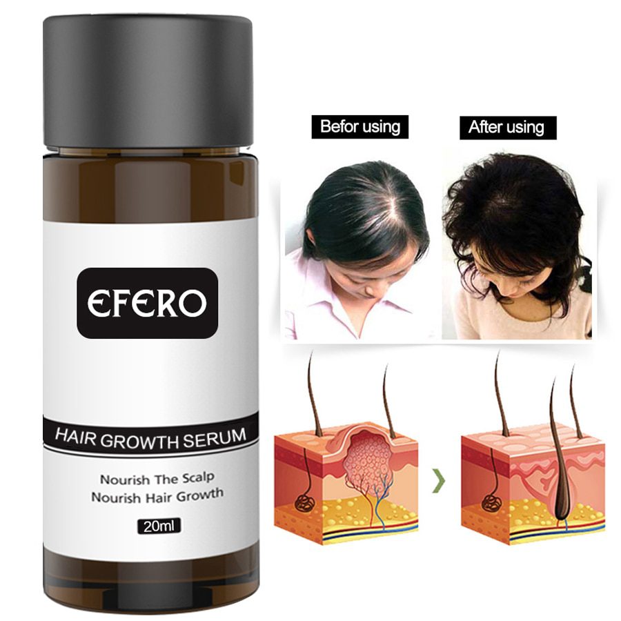 Hair Growth Essence Hair Loss Dense Hair Fast Hair Growth Oil Grow Restoration Growing Serum