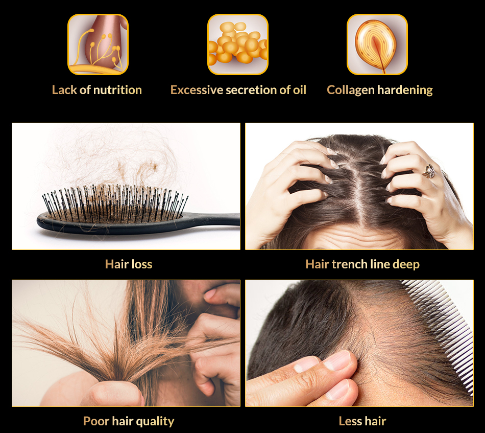 OMY LADY Anti Hair Loss Hair Growth Spray Essential Oil Liquid  For Men Women Dry Hair  Regeneration Repair,Hair Loss Products