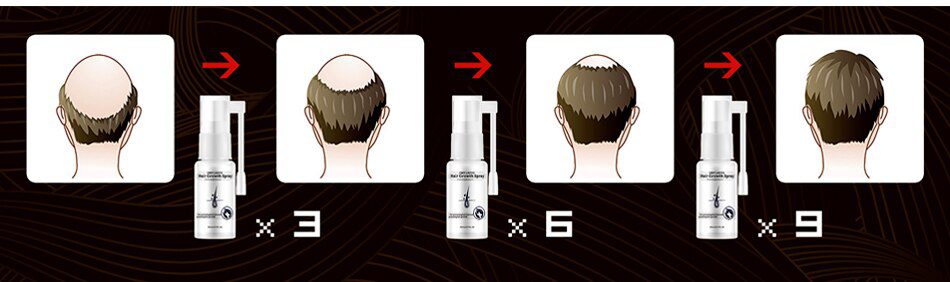 OMY LADY Anti Hair Loss Hair Growth Spray Essential Oil Liquid  For Men Women Dry Hair  Regeneration Repair,Hair Loss Products