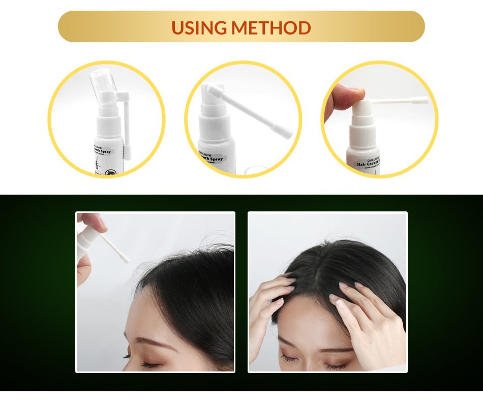 OMY LADY Anti Hair Loss Hair Growth Spray Essential Oil Liquid  For Men Women Dry Hair  Regeneration Repair,Hair Loss Products