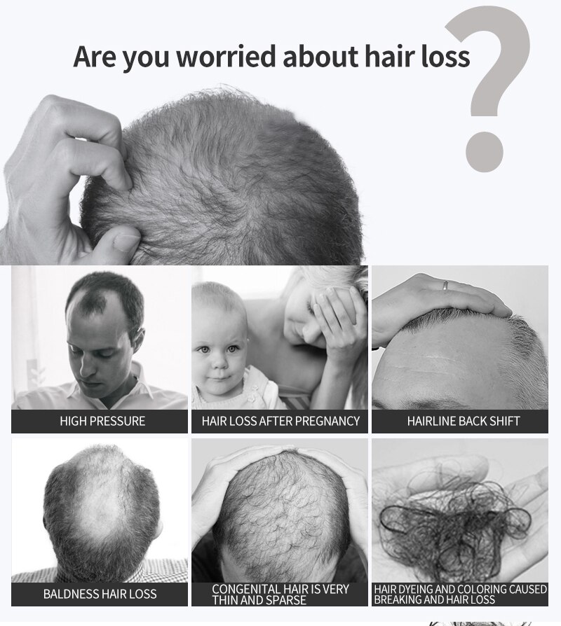 PURC 2019 New Hair Growth Spray Fast Grow Hair hair lossTreatment Preventing Hair Loss 30ml