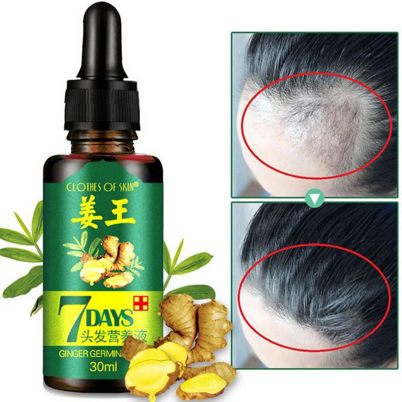 30ml Hair Growth Serum Essence for Women and Men Anti preventing Hair Loss alopecia Liquid Damaged Hair Repair Growing Faster