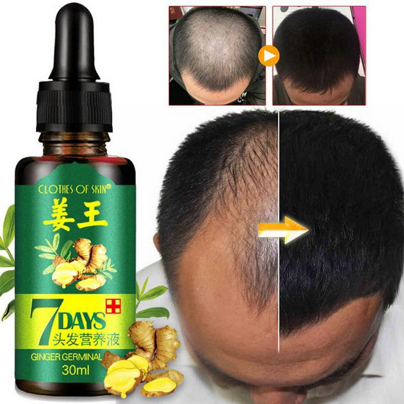 30ml Hair Growth Serum Essence for Women and Men Anti preventing Hair Loss alopecia Liquid Damaged Hair Repair Growing Faster