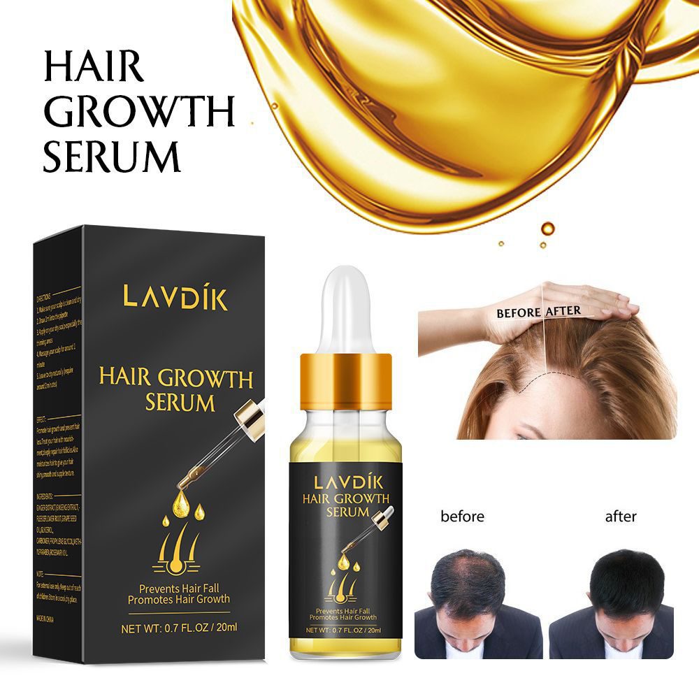 LAVDIK Ginger Fast Hair Growth Serum Essential Oil Anti Preventing Hair Lose Liquid Damaged Hair Repair Growing Women Men TSLM1