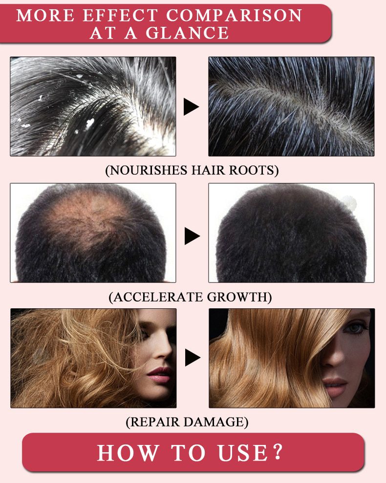 New Arrival Andrea Hair Growth Products Ginger Oil Hair Growth Faster Grow Hair Ginger Shampoo Stop Hair Loss Treatment