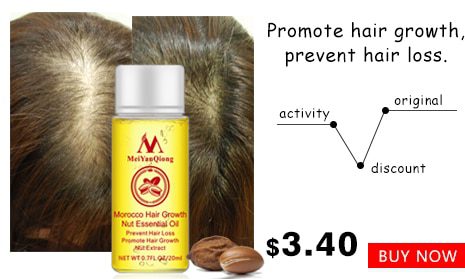 New Arrival Andrea Hair Growth Products Ginger Oil Hair Growth Faster Grow Hair Ginger Shampoo Stop Hair Loss Treatment