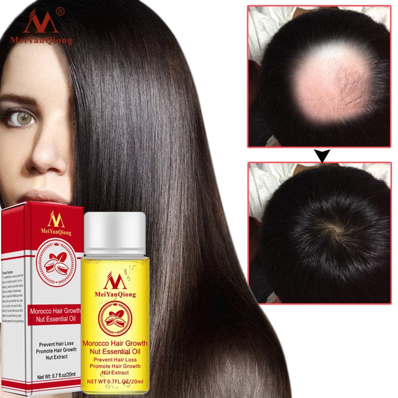 New Arrival Andrea Hair Growth Products Ginger Oil Hair Growth Faster Grow Hair Ginger Shampoo Stop Hair Loss Treatment