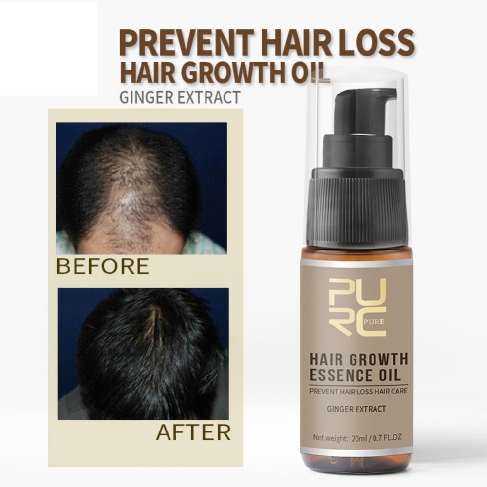 Powerful Hair Growth Essence Hair Loss Products Essential Oil Liquid Treatment Preventing Pomade Loss Hair Care Product