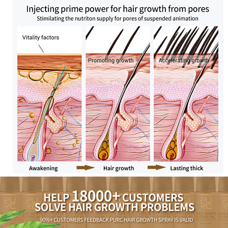 Powerful Hair Growth Essence Hair Loss Products Essential Oil Liquid Treatment Preventing Pomade Loss Hair Care Product