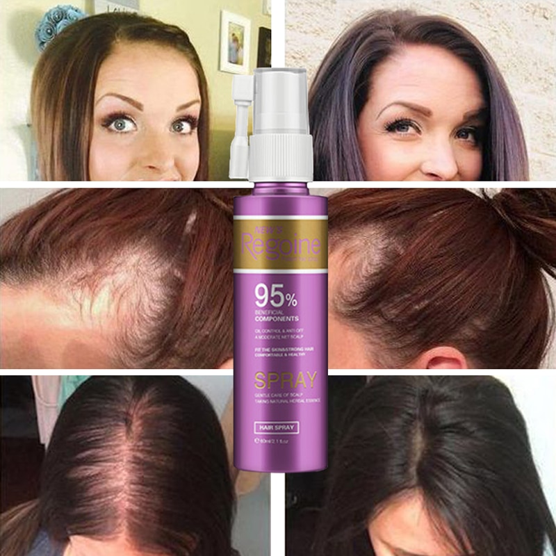 Anti Hair Loss Essence Hair Growth Treatment Oil Fast Thick Hair Eyebrows Support Natural Healthy Hair Treatment for Women