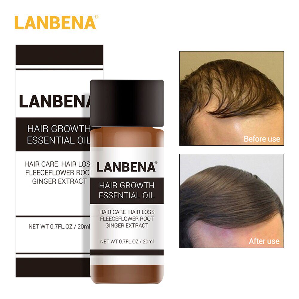 LANBENA Fast Powerful Hair Growth Essence Products Essential Oil Treatment Preventing Hair Loss Hair Care Andrea 20ml !