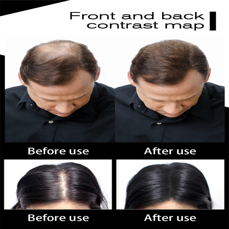 Regrowth Powders Hair Fibers Keratin Thickening Spray Hair Building Multi-colors Hair Loss Hair Regrowth Powders Hot Instant Wig