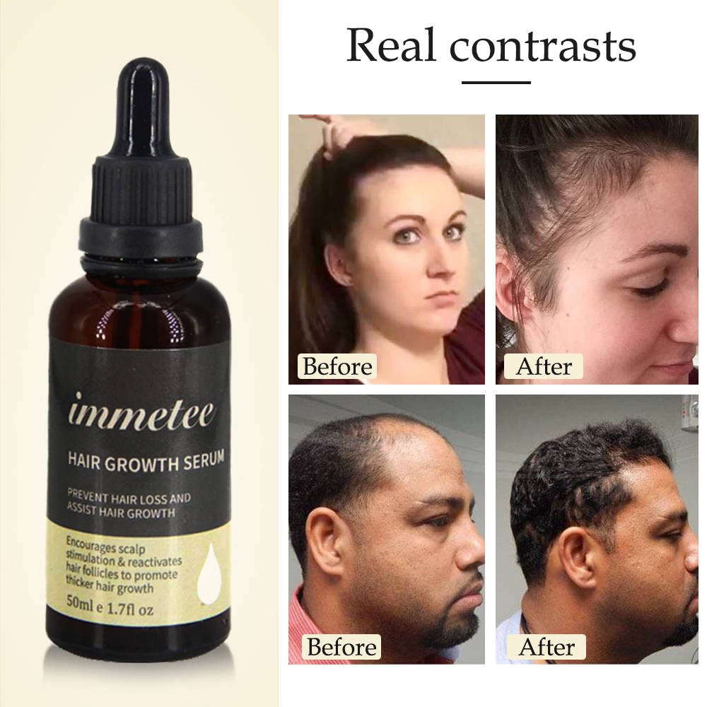 Hair Growth Essence Oil Anti Hair Loss Treatment for Beard Growth Oil Repair Damage Hair Roots Hair Care Products Hair Tonic