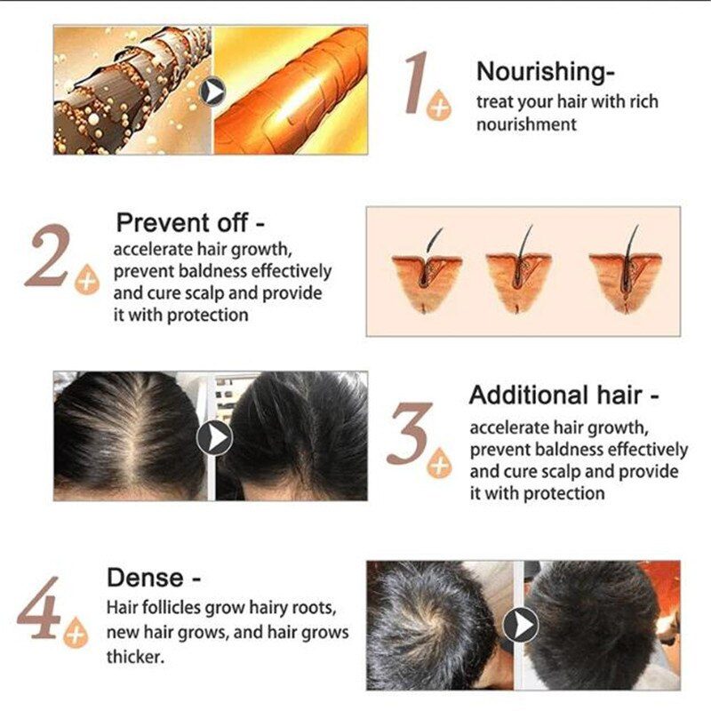 Oriental Oils Hair Nutrition Hair Loss Treatment Solutions Product Fast Hair Growth Remedy Essence Oil Hair Regrowth Products