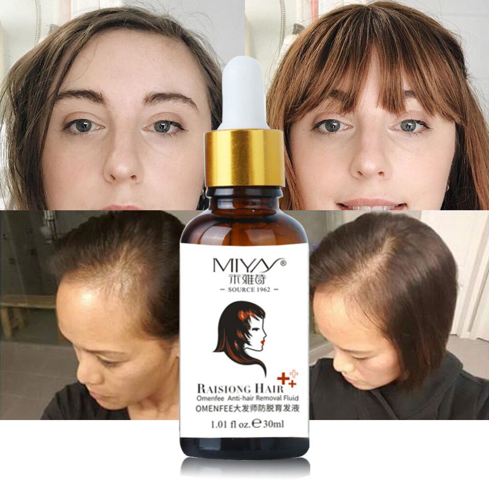 Hair Growth Essence Oil Anti Hair Loss Treatment for Hair Growth Hair Care Anti Preventing Hair Loss Products Hair Tonic