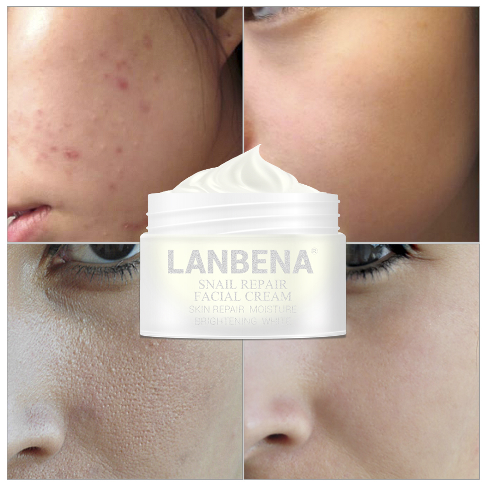 LANBENA Snail Repair Whitening Facial Cream Day Cream Anti Wrinkle Anti Aging Acne Treatment Moisturizing Firming Skin Care 30g
