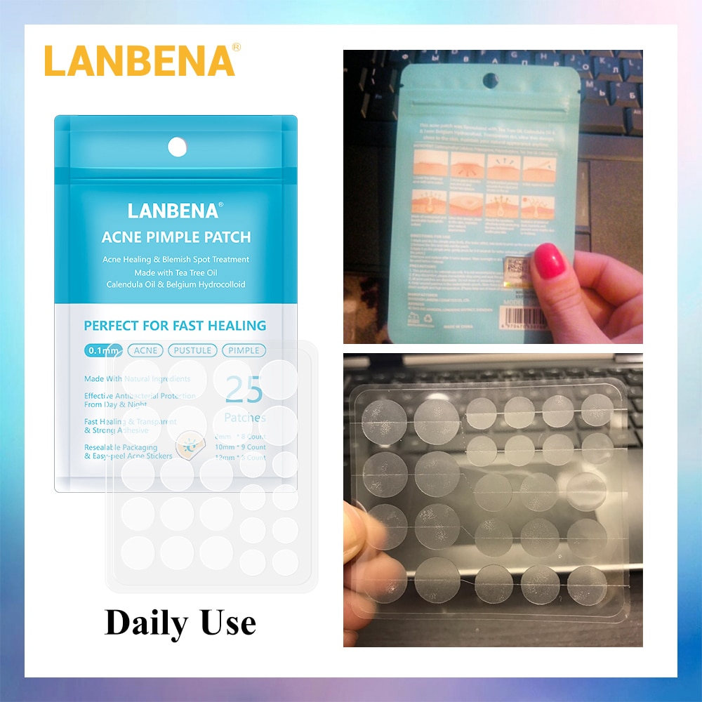 LANBENA Acne Pimple Patch 25pcs Daily Use Invisible Acne Stickers Blemish Treatment Acne Master Face Mask Beauty Tool Skin Care