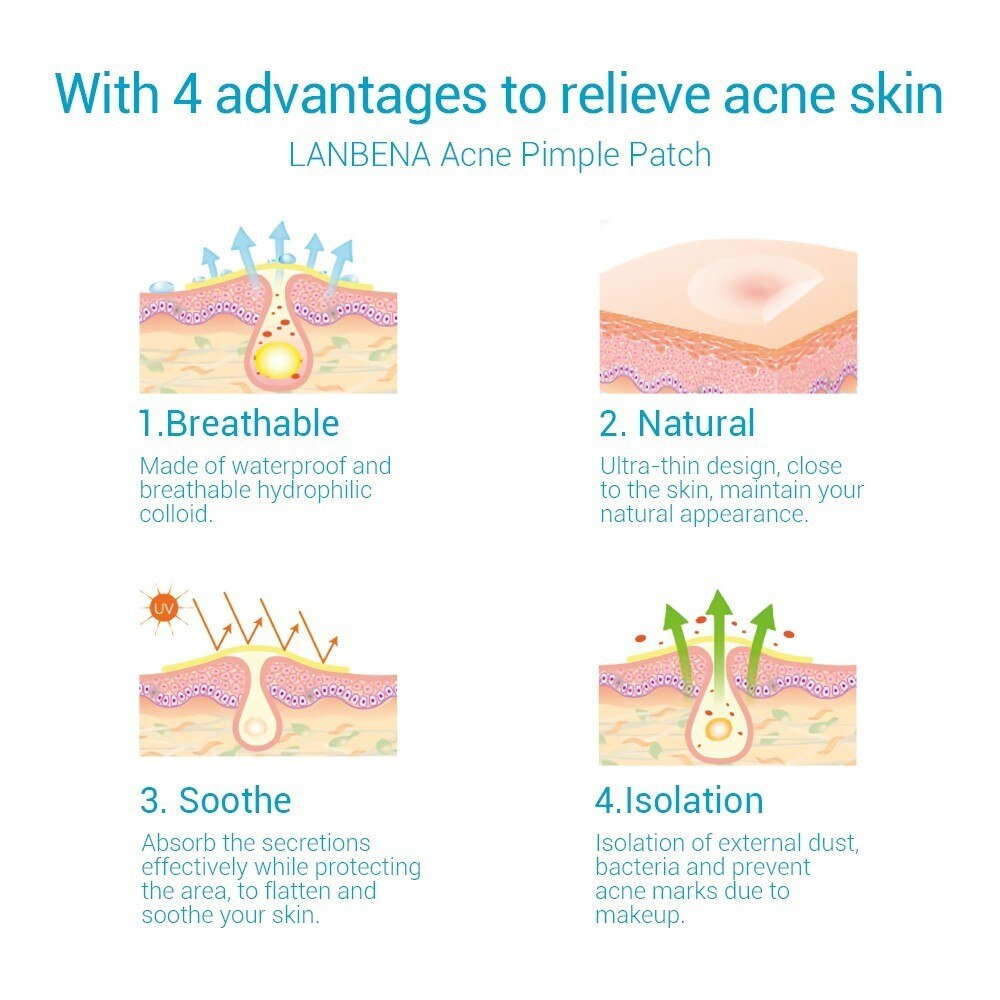 LANBENA Acne Removal Patch Acne Treatment Mask Anti Acne Stickers Blackhead Pimple Remover Face Cream Facial Tool Skin Care