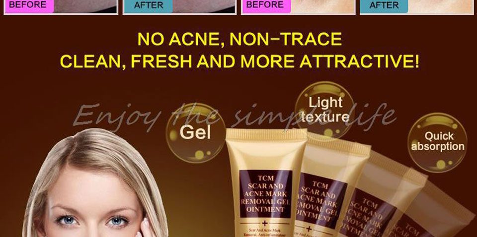 LANBENA Acne Scar Removal Strentch Marks Acne Treatment Shrink Pores Gel Bleaching Essence Whitening  Face Cream Skin Care