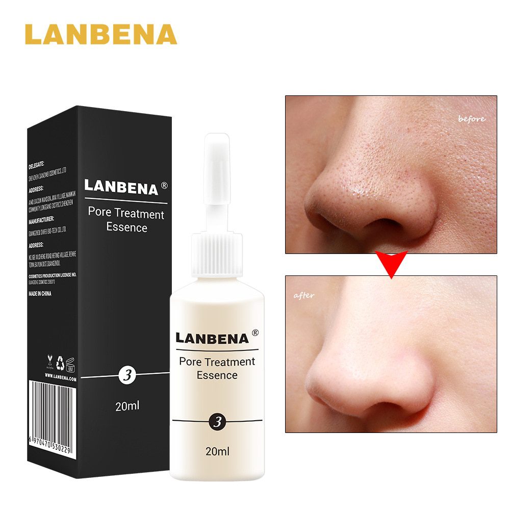 LANBENA Acne Scar Removal Strentch Marks Acne Treatment Shrink Pores Gel Bleaching Essence Whitening  Face Cream Skin Care