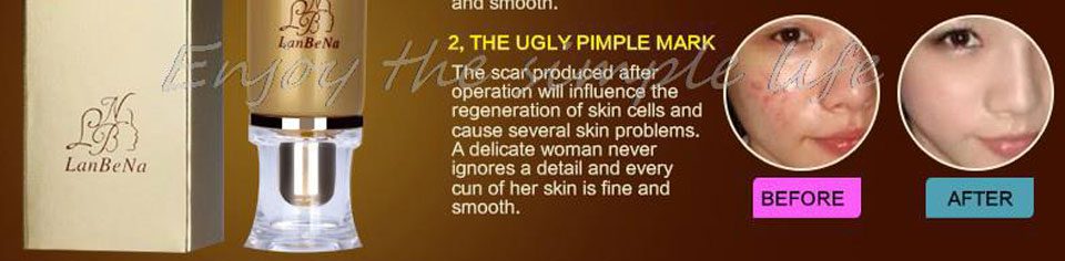 LANBENA Acne Scar Removal Strentch Marks Acne Treatment Shrink Pores Gel Bleaching Essence Whitening  Face Cream Skin Care