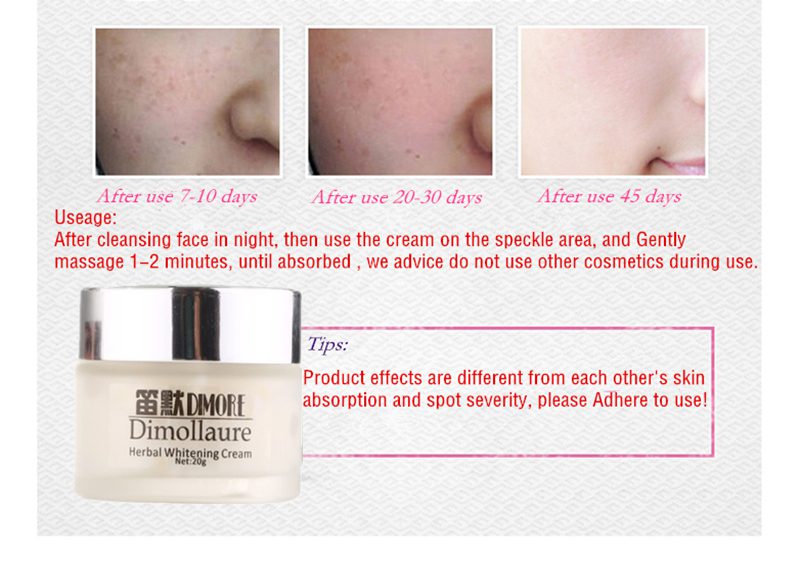 Dimollaure Strong effect whitening cream +Kojic acid serum Remove Freckle melasma pigment Melanin sunburn Acne scars brown Spot