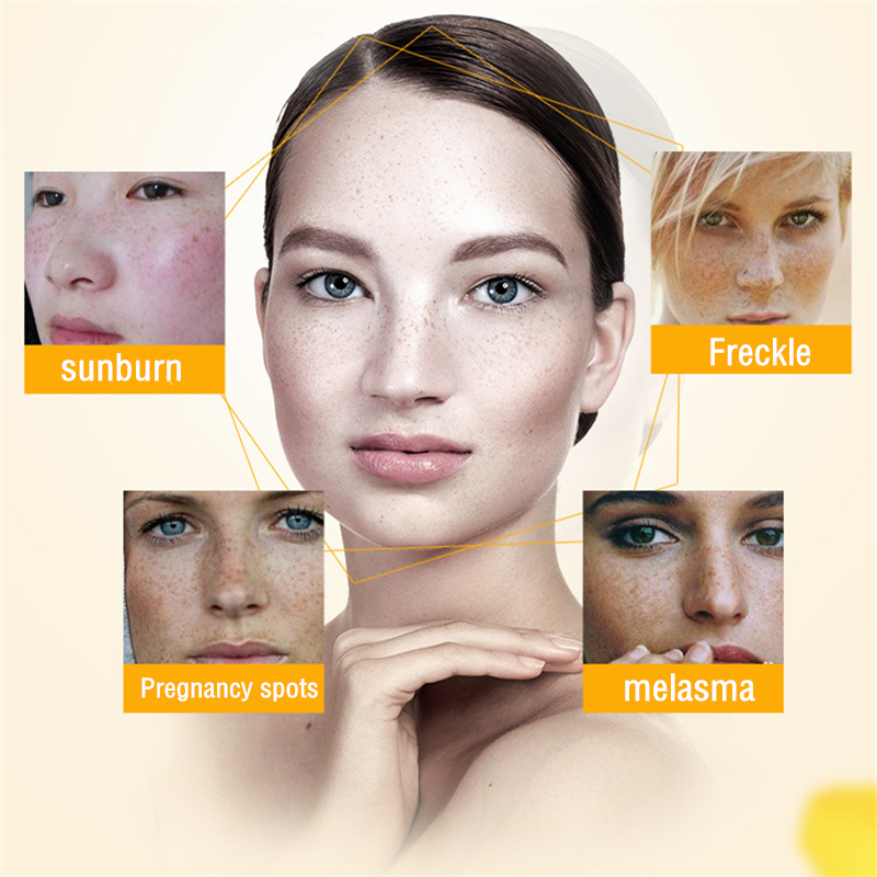 Dimollaure Strong effect whitening cream +Kojic acid serum Remove Freckle melasma pigment Melanin sunburn Acne scars brown Spot