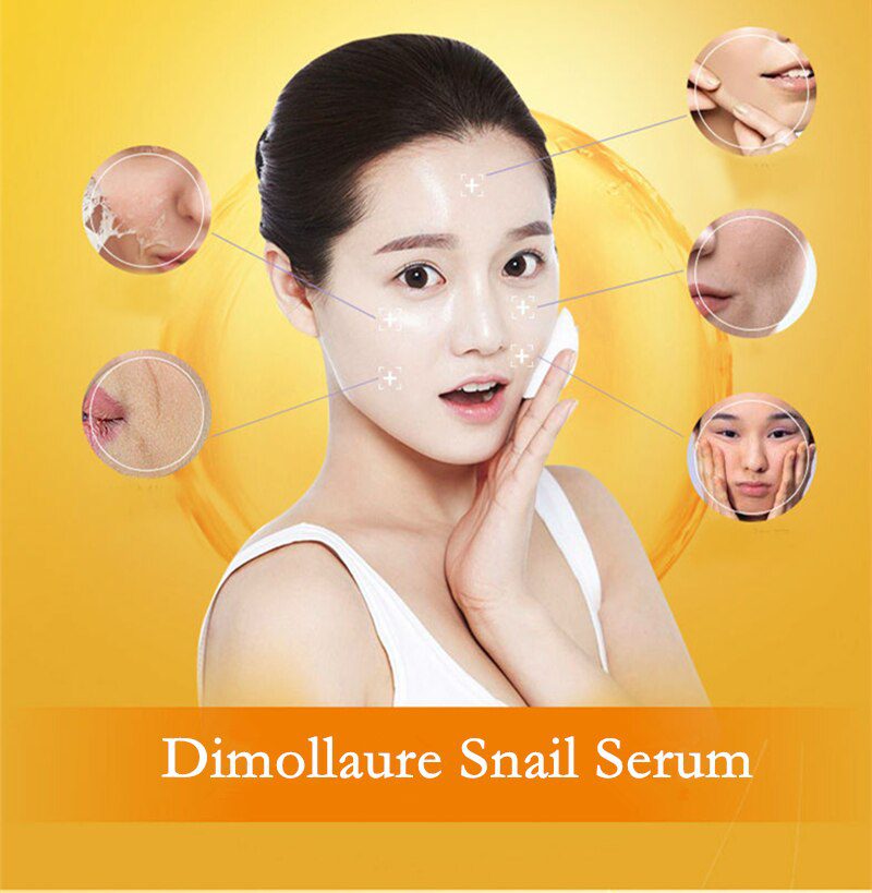 Dimollaure 30g pure Kojic Acid whitening cream+Kojic Acid serum Wrinkle removal Freckle melasma Acne scar pigmentt melanin cream