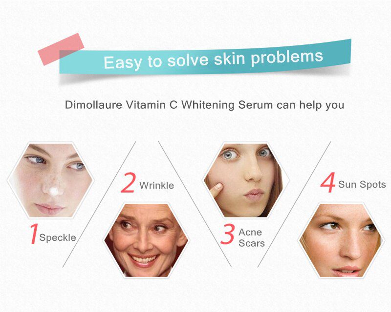 Dimollaure 30g pure Kojic Acid whitening cream+Kojic Acid serum Wrinkle removal Freckle melasma Acne scar pigmentt melanin cream