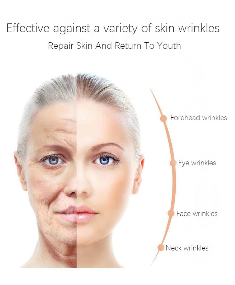 Dimollaure whitening Freckle cream+Fullerene 24k Gold Serum Anti-aging wrinkle Serum Removal melasma sunburn brown spot melanin