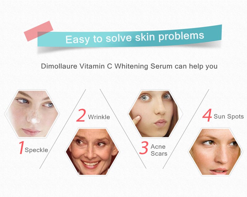 Dimollaure 30g pure Kojic Acid whitening cream+Vitamin C serum removal Acne Pimples Anti Aging pigmentt melanin Wrinkle cream