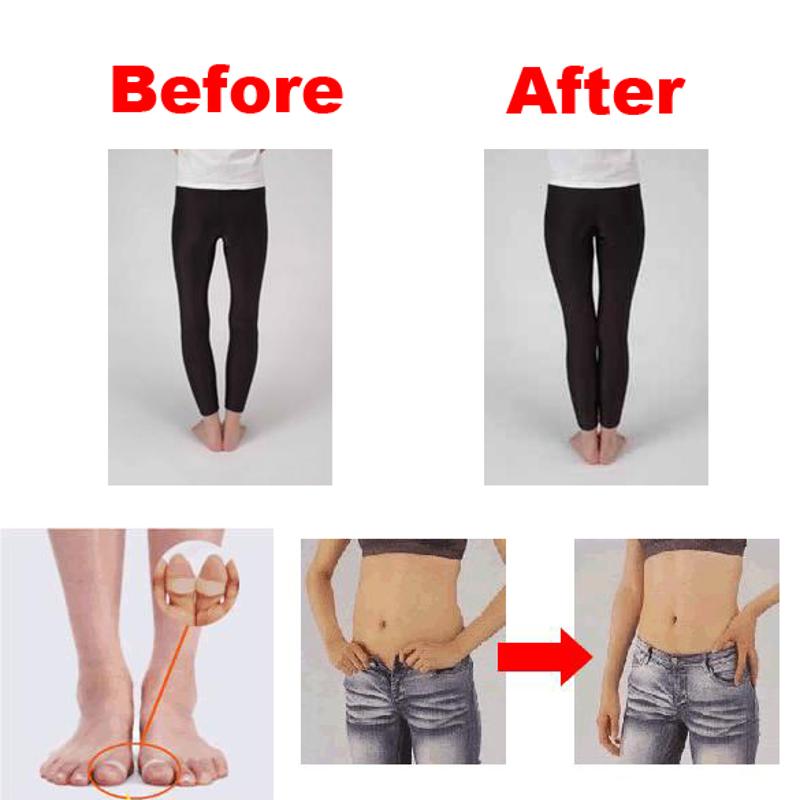 2pcs Fast Lose Weight Toe Rings Magnetic Slimming Body Product Foot Massage Burn Fat Keep Fit Body Shaper Best Selling