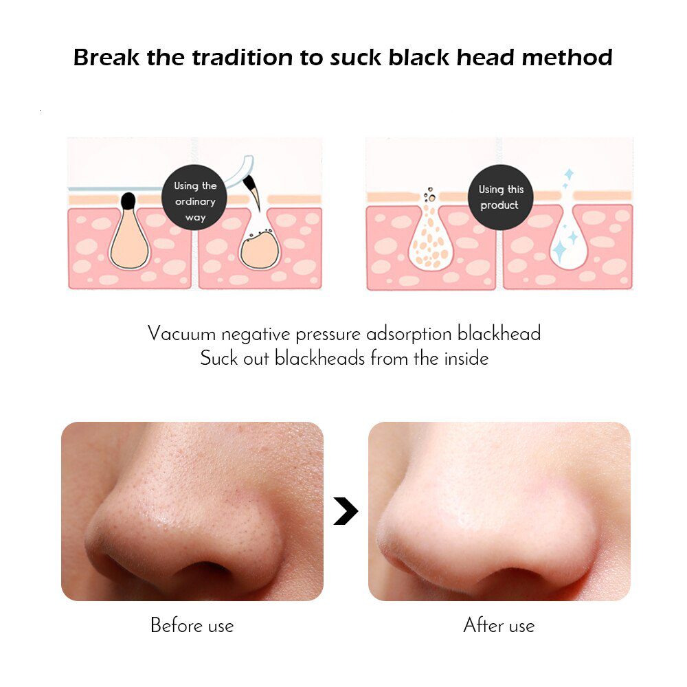 Electric Blackheads Pore Remover Face Nose Vaccum Deep Cleaning Blackheads Tools  Facial Steamer Spa Moisturizing Skin Care