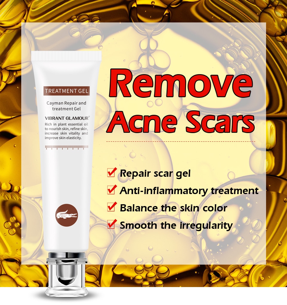 VIBRANT GLAMOUR Repair Scar Removal Cream Acne Scars Gel Stretch Marks Surgical Scar Burn For Body Pigmentation Corrector Care