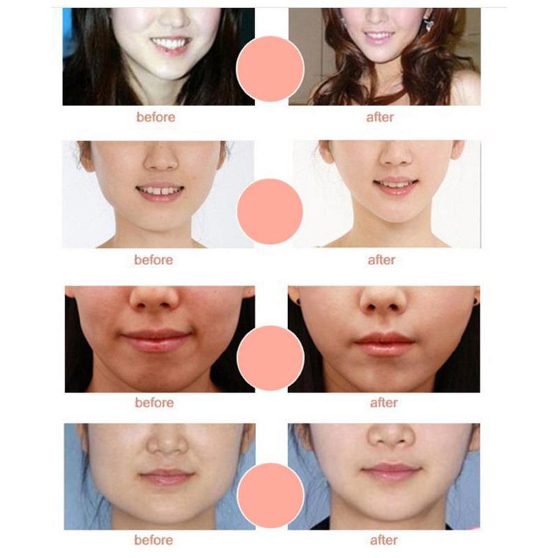 1pcs Face Miracle Slimming Mask Facial Miracle V-Shaped Lifting Facial Neck Miracle Mask Face Firming Skin Care Tool