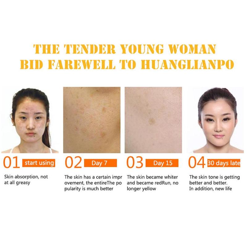 100% Pure Vitamin C Serum Liquid Freckle Removal Acne Scars Hyaluronic Acid Anti-wrinkle Vc Face Serum Fade Dark Spot