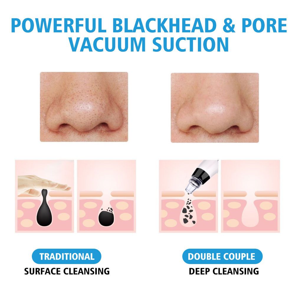 Blackhead Remover Vacuum Pore Cleaner Electric Nose Face Deep Cleansing Skin Care Machine Birthday Gift Dropshipping Beauty Tool